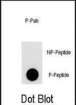 Phospho-VPS34 (Ser676) Antibody in Dot Blot (DB)