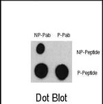 Phospho-ATF2 (Ser322) Antibody in Dot Blot (DB)