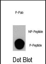 Phospho-VPS34 (Ser164) Antibody in Dot Blot (DB)