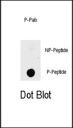 Phospho-PAK1 (Thr423) Antibody in Dot Blot (DB)