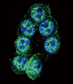 Phospho-PAK1 (Thr423) Antibody in Immunocytochemistry (ICC/IF)