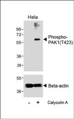 Phospho-PAK1 (Thr423) Antibody in Western Blot (WB)