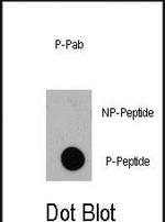 Phospho-4EBP1 (Thr36) Antibody in Dot Blot (DB)