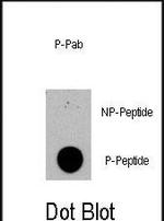 Phospho-TSC2 (Ser1420) Antibody in Dot Blot (DB)