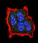 Phospho-TSC2 (Ser1420) Antibody in Immunocytochemistry (ICC/IF)