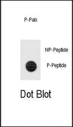 Phospho-TERT (Ser1125) Antibody in Dot Blot (DB)