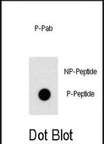 Phospho-OSR1 (Thr310) Antibody in Dot Blot (DB)