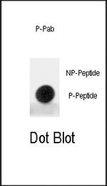 Phospho-MDM2 (Ser395) Antibody in Dot Blot (DB)