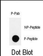 Phospho-HIPK2 (Tyr361) Antibody in Dot Blot (DB)