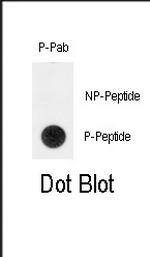 Phospho-TERT (Tyr707) Antibody in Dot Blot (DB)