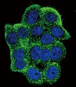 Phospho-TERT (Tyr707) Antibody in Immunocytochemistry (ICC/IF)