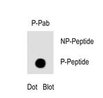 Phospho-TBK1 (Ser172) Antibody in Dot Blot (DB)