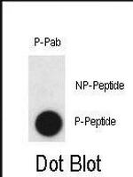 Phospho-Claudin 2 (Tyr224) Antibody in Dot Blot (DB)