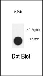 Phospho-SMAD2 (Ser118) Antibody in Dot Blot (DB)
