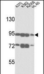 ABCB5 Antibody in Western Blot (WB)