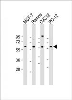 XIAP Antibody in Western Blot (WB)