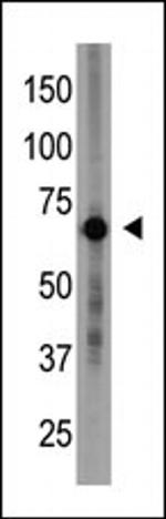 CRY1 Antibody in Western Blot (WB)