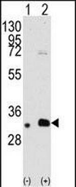 MAGEB2 Antibody in Western Blot (WB)