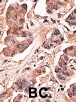 MAGEH1 Antibody in Immunohistochemistry (Paraffin) (IHC (P))