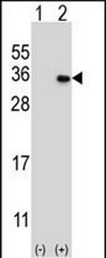 MAGEH1 Antibody in Western Blot (WB)