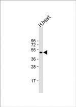 MMP12 Antibody in Western Blot (WB)