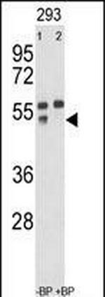 MMP12 Antibody in Western Blot (WB)