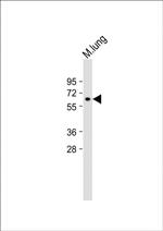 MMP14 Antibody in Western Blot (WB)