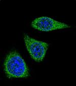 MMP7 Antibody in Immunocytochemistry (ICC/IF)