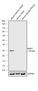 MMP7 Antibody in Western Blot (WB)