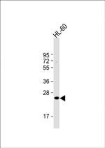 MMP7 Antibody in Western Blot (WB)