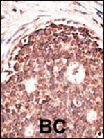 MMP9 Antibody in Immunohistochemistry (Paraffin) (IHC (P))