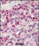 MMP9 Antibody in Immunohistochemistry (Paraffin) (IHC (P))