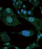 NOTCH3 Antibody in Immunocytochemistry (ICC/IF)