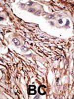 NOTCH3 Antibody in Immunohistochemistry (Paraffin) (IHC (P))