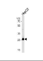 SIRT3 Antibody in Western Blot (WB)