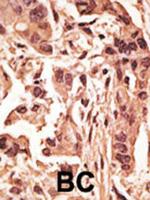 SIRT6 Antibody in Immunohistochemistry (Paraffin) (IHC (P))