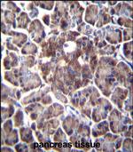 DDIT4 Antibody in Immunohistochemistry (Paraffin) (IHC (P))