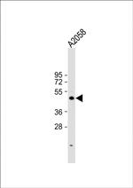 Cyclin E Antibody in Western Blot (WB)