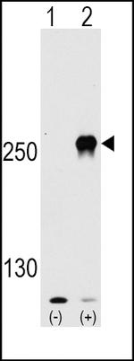 mTOR Antibody in Western Blot (WB)