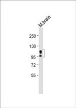 Amyloid Precursor Protein Antibody in Western Blot (WB)