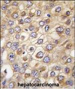 Claudin 2 Antibody in Immunohistochemistry (Paraffin) (IHC (P))