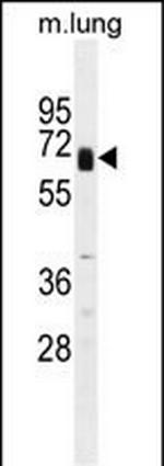 Glypican 3 Antibody in Western Blot (WB)