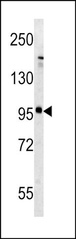 mGluR5 Antibody in Western Blot (WB)