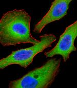 TSC2 Antibody in Immunocytochemistry (ICC/IF)