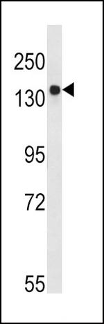 TSC2 Antibody in Western Blot (WB)