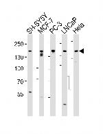 TSC2 Antibody in Western Blot (WB)