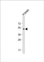 Parkin Antibody in Western Blot (WB)