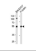 Parkin Antibody in Western Blot (WB)