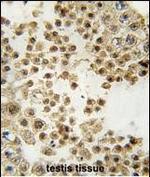 Parkin Antibody in Immunohistochemistry (Paraffin) (IHC (P))