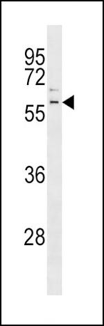 Parkin Antibody in Western Blot (WB)